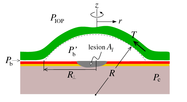 Cornea mechanics and fluid-solid interactions in the eye