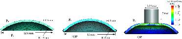 Cornea mechanics and fluid-solid interactions in the eye