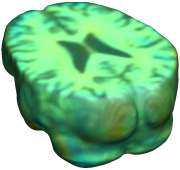 COMPUTATIONAL ANATOMY